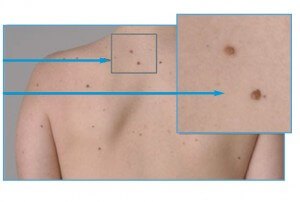 body mapping example