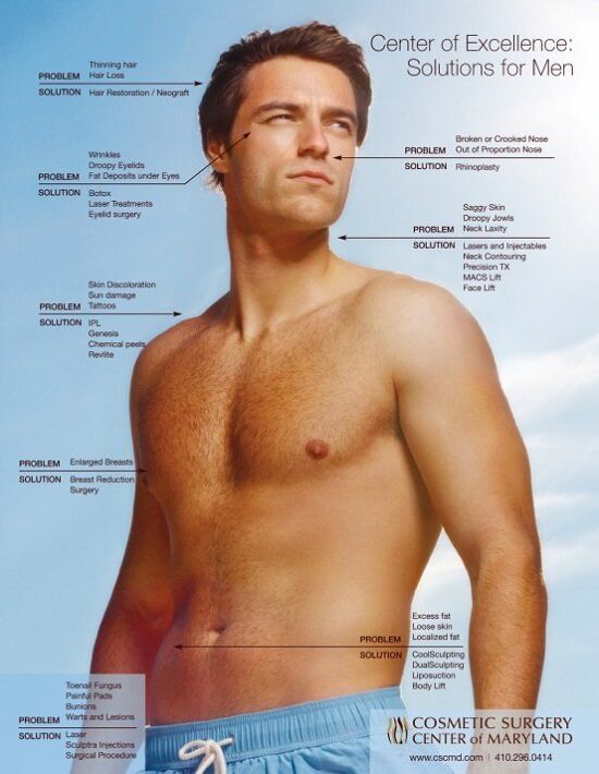platic surgery for men diagram