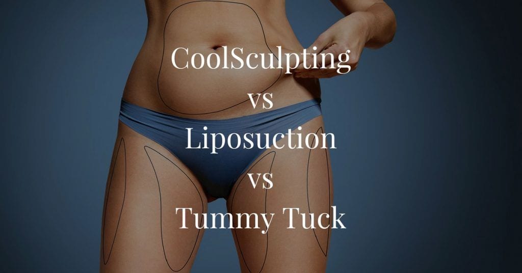 Dr. Trussler Liposuction Surgery Austin
