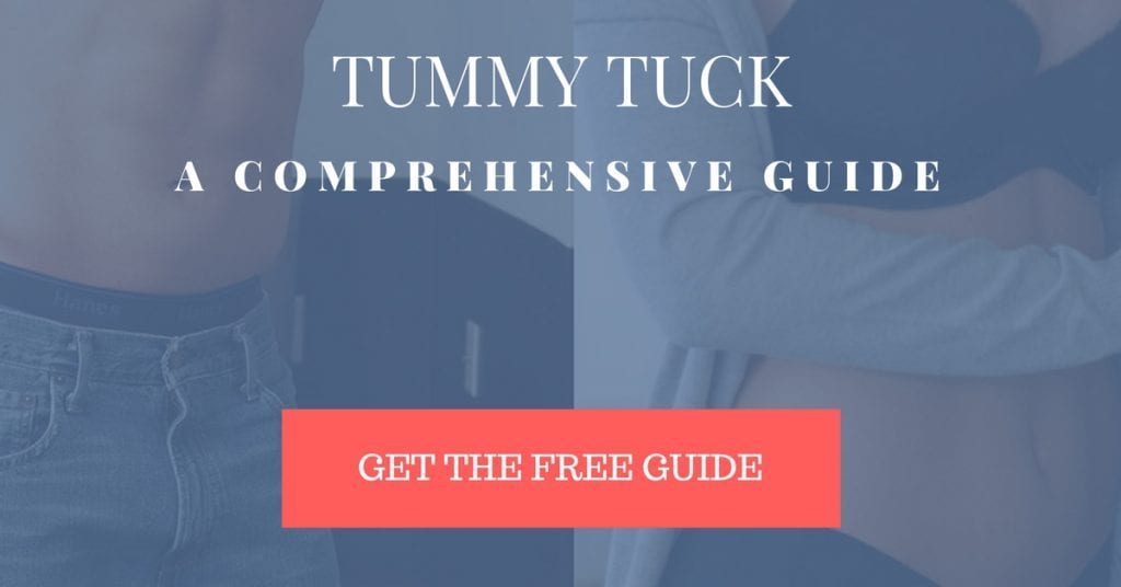 Tummy Tuck Ebook Download