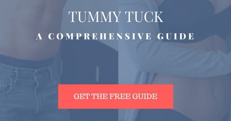 tummy tuck recovery week 2 tummy tuck recovery week 2