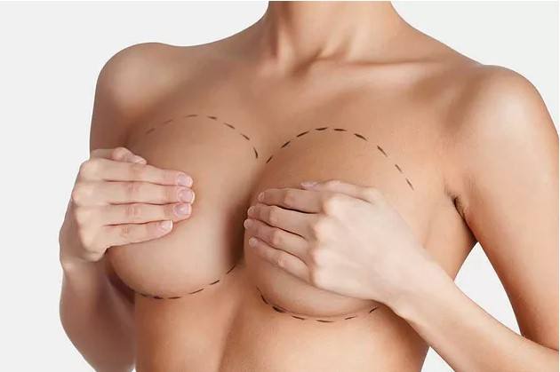 how-to-choose-breast-implants