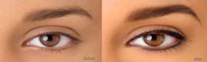 Cosmetic Eyebrow Tattooing Before & After