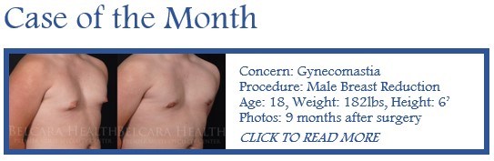 Male Breast Reduction case of the month