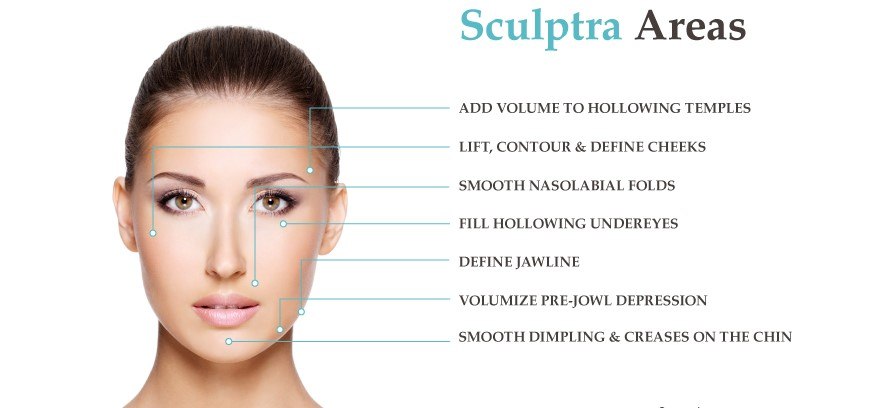 Sculptra Areas