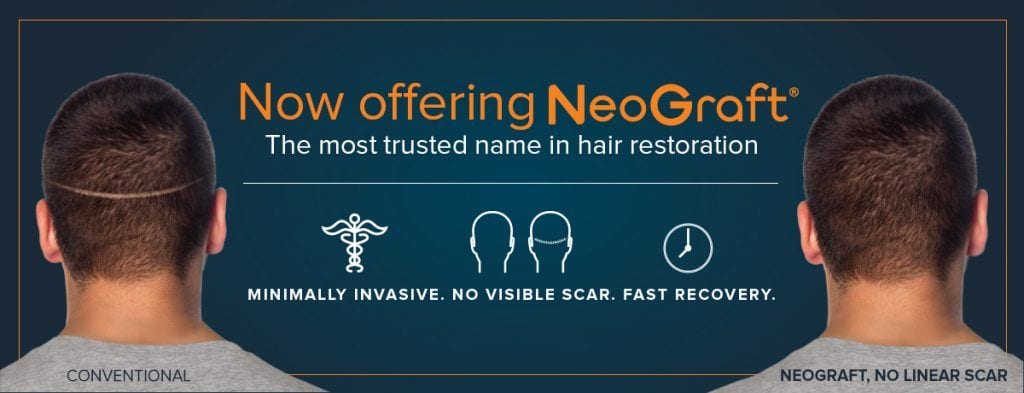 Now Offering Neograft