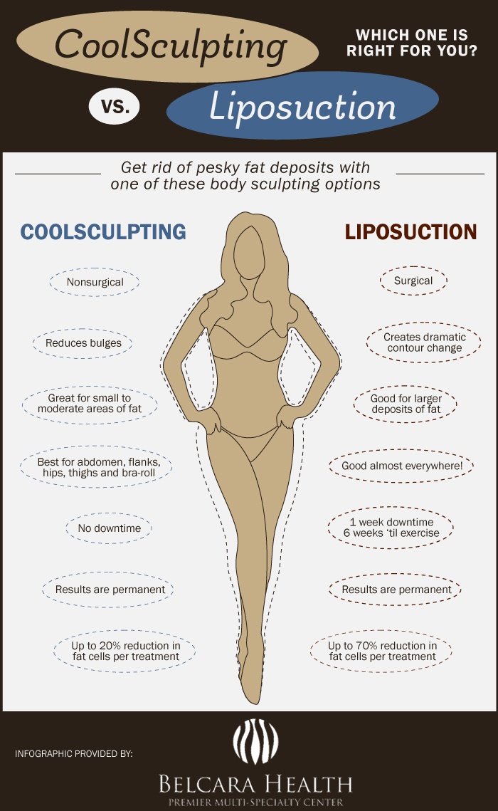 Coolsculpting versus Liposuction infographic