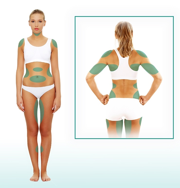 infographic highlighting areas of body for liposuction