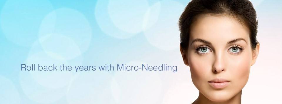 roll back the years with microneedling